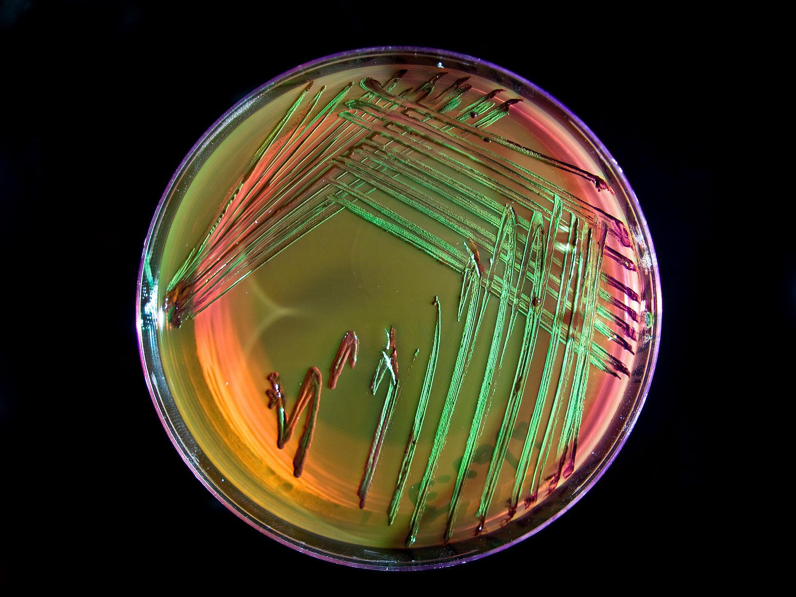 Cultivo de bacteria Escherichia coli en placa de Petri